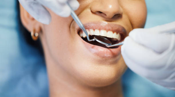 Best Emergency Wisdom Tooth Extraction in Colfax, WA